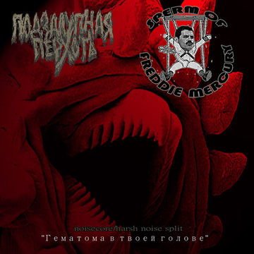 Гематома в твоей голове.jpg