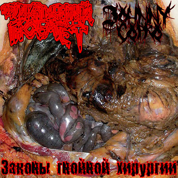 File:Законы гнойной хирургии.jpg